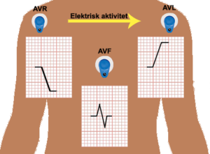 Body-electrodes-middle-png