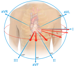 EKG_leads (1)