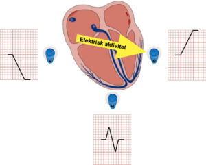 Heart-3-point-electrodes-with-ecg-expn-png
