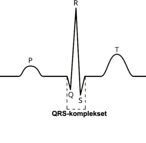 QRS-kompleks-png