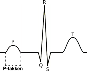 Sinus-rytme-p-takken-png