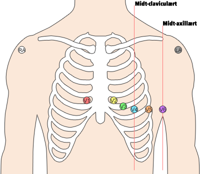 body-leads-placement-2-6-png