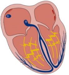 hjerte-default-ventrikulær-depolarisering-png